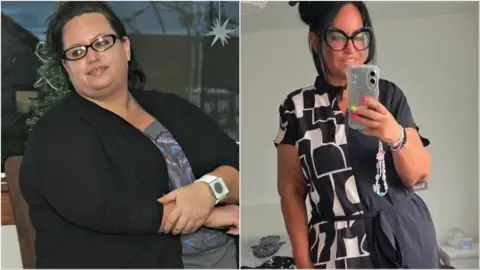 They Shed Weight With Shots – Followed By the Sagging Skin