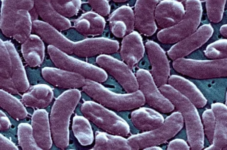The Bayou State Confirms 5 Fatalities from Flesh-Eating Bacteria in Coastal Seawater
